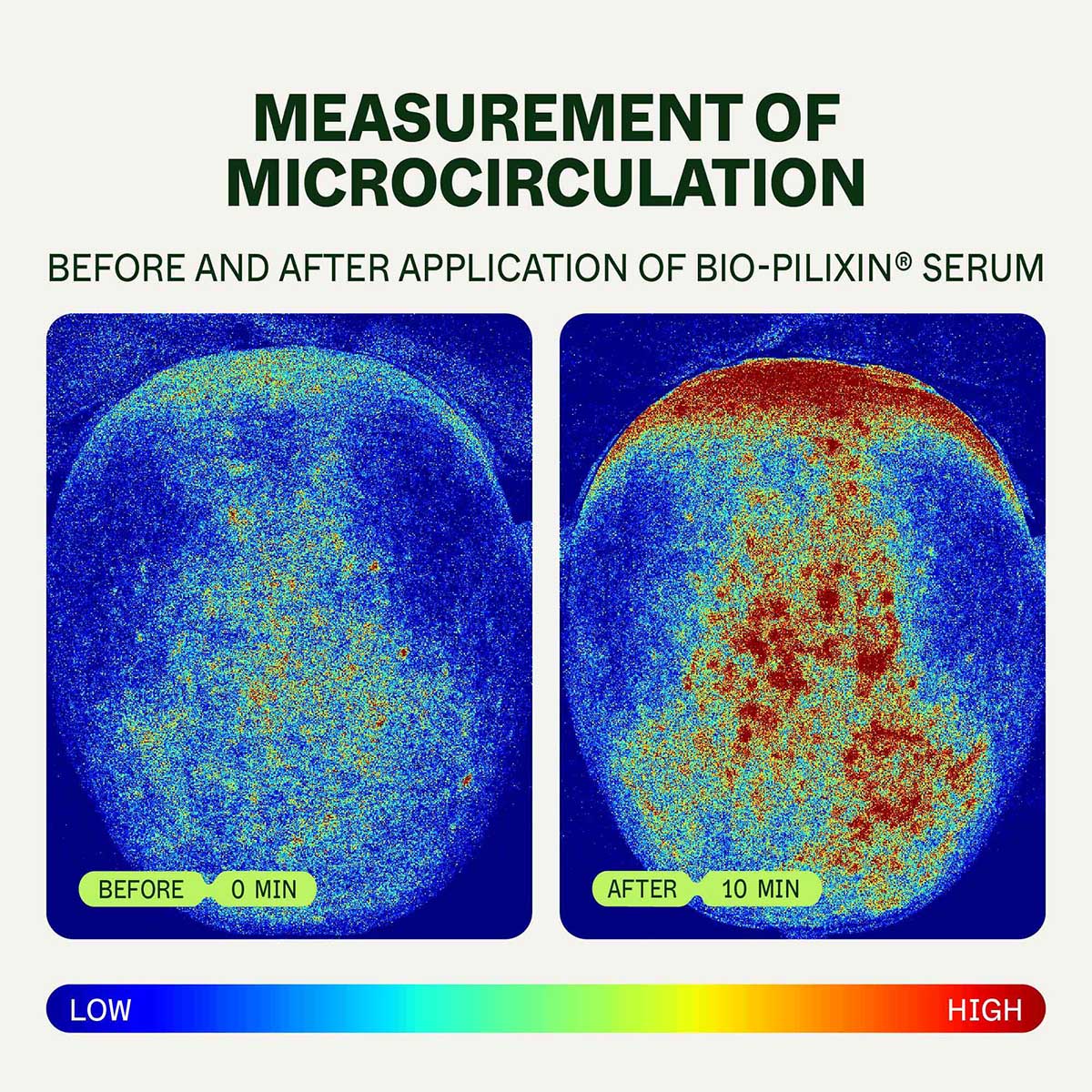 Hair Growth Routine | For Women